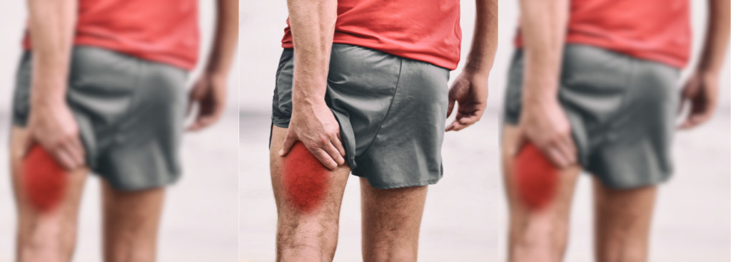 How to manage hamstring muscle injuries
